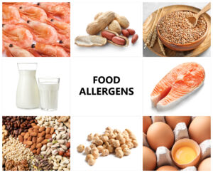 food allergens